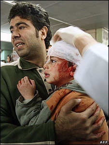 _45330566_wounded_boy_226afp