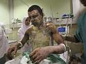 GazaSlide_9__585x43_464433a