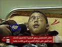 img_4bd72cba82_child_blind_gaza_dime_aljazeera
