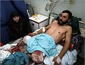 img_5296811527_gaza_man_wounded_wife_aljazeera